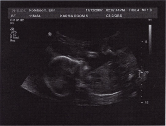 20071217-ultrasound-01.jpg